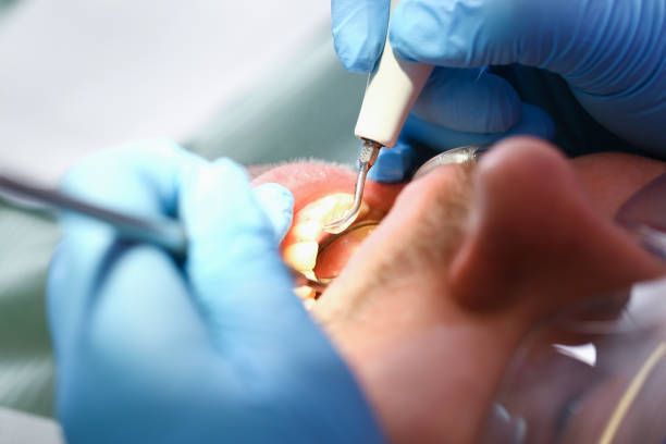 Best Emergency Dentist for Lost Fillings or Crowns in Wallace, ID