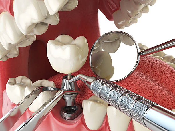 Best Emergency Dental Services for Seniors in Wallace, ID
